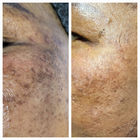 Elaine Brennan Get Glowing Peel